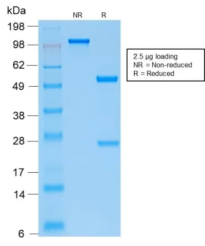 Anti-Parathyroid Hormone (PTH) (N-Terminal) (PTH/2295R) - image 1