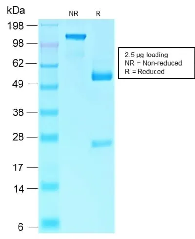 Anti-Rb1 (Tumor Suppressor Protein) (RB1/2313R) - image 2