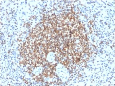 Anti-Bcl-2 (Apoptosis & Follicular Lymphoma Marker) (BCL2/2210R) - image 1