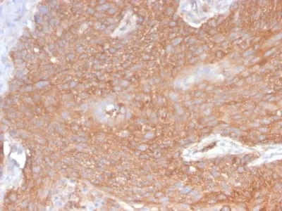 Anti-Spectrin beta III (SPTBN2) (SPTBN2/2894R) - image 3