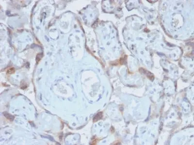 Anti-TIMP2 (Tissue Inhibitor of Metalloproteinase 2) (TIMP2/2488R) - image 1