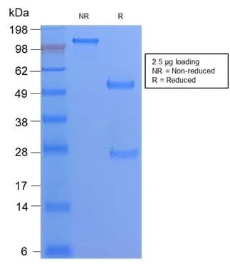 Anti-CD68 (Macrophage Marker) (C68/2908R) - image 2