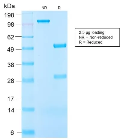 Anti-Insulin-like Growth Factor-1 (IGF-1) (IGF1/2872R) - image 1
