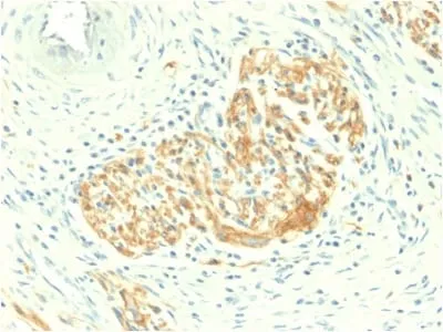 Anti-CD56 / NCAM1 / NKH1 (Neuronal Cell Marker) (NCAM1/2217R) - image 1