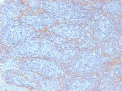 Anti-Catenin, beta (CTNNB1) (CTNNB1/2098) - image 1