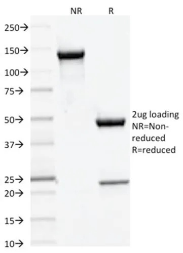 Anti-DNMT3A / DNA Methyltransferase 3 Alpha (PCRP-DNMT3A-1E2) - image 2
