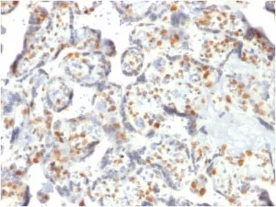 Anti-DNMT3A / DNA Methyltransferase 3 Alpha (PCRP-DNMT3A-1E2) - image 1