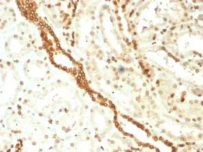 Anti-Emerin (Papillary Thyroid Carcinoma and EDMD Marker) (EMD/2168) - image 3