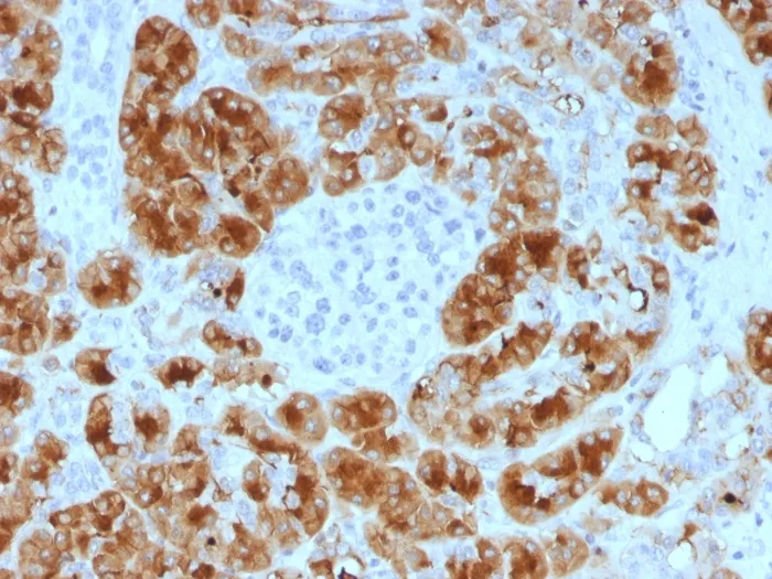 Anti-GP2 (Glycoprotein 2) / ZAP75 (GP2/1805) - image 1