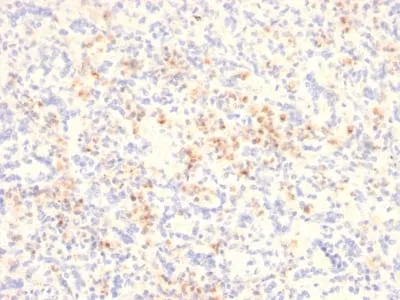 Anti-Granzyme B (NK/T-Cell Lymphoma Marker) (GZMB/2403) - image 2