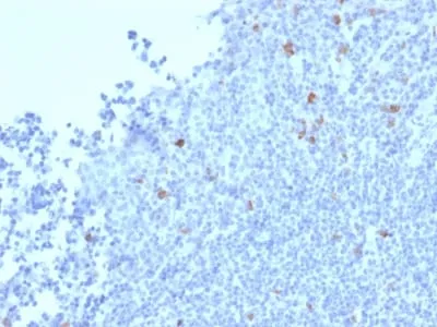 Anti-Granzyme B (NK/T-Cell Lymphoma Marker) (GZMB/2403) - image 1