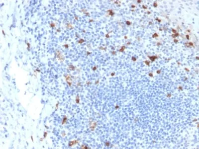 Anti-CD103 / Integrin alpha E (T-Cell Lymphoma & Hairy Cell Leukemia Marker) (ITGAE/2063) - image 3