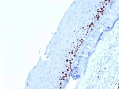 Anti-Ki-67 (Proliferating Cell Marker) (MKI67/2462) - image 3