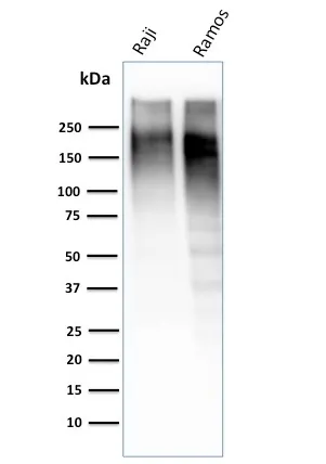Anti-Ki-67 (Proliferating Cell Marker) (MKI67/2462) - image 7
