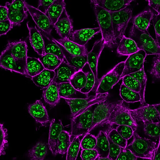 Anti-Ki-67 (Proliferating Cell Marker) (MKI67/2462) - image 1