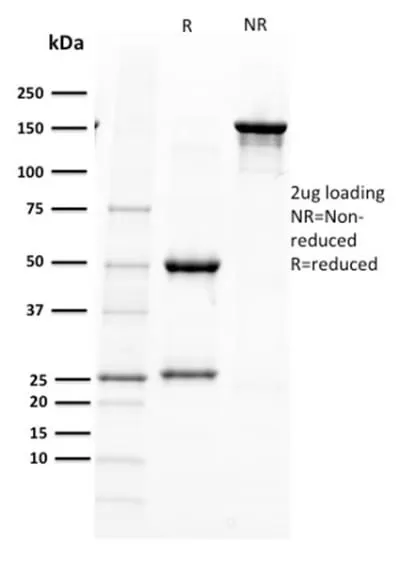 Anti-PAX5 / BSAP (Early B-Cell Marker) (PAX5/2595) - image 2