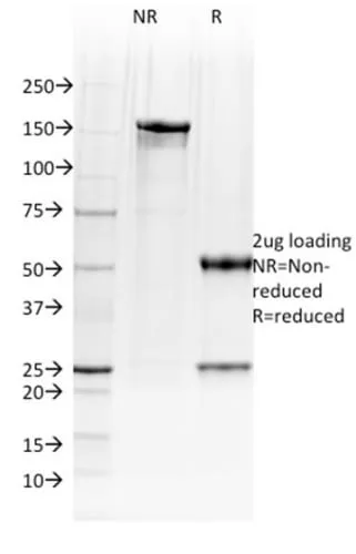 Anti-BOB.1 (B-Cell Marker) (BOB1/2423) - image 2