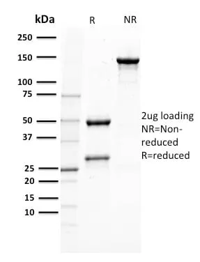 Anti-gp100 / Melanosome / PMEL17 / SILV (Melanoma Marker) (PMEL/2037) - image 3