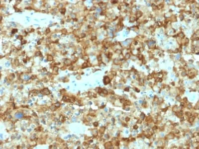 Anti-gp100 / Melanosome / PMEL17 / SILV (Melanoma Marker) (PMEL/2037) - image 1