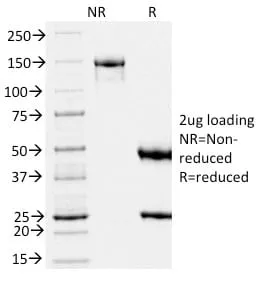 Anti-gp100 / Melanosome / PMEL17 / SILV (Melanoma Marker) (PMEL/2039) - image 3