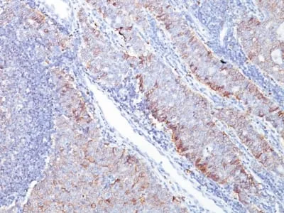 Anti-GLUT-1 (Tumor Progression and Mesothelioma Marker) (GLUT1/2476) - image 1