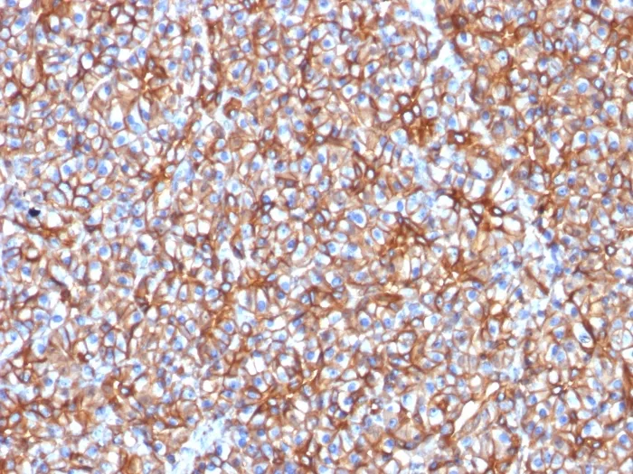 Anti-Spectrin beta III (SPTBN2) (SPTBN2/1778) - image 1
