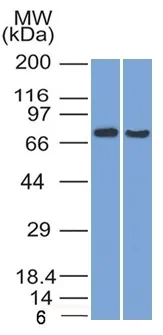 Anti-TCF4 (Transcription Factor 4) (TCF4/1705) - image 1