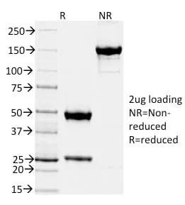Anti-TIMP2 (Tissue Inhibitor of Metalloproteinase 2) (TIMP2/2044) - image 2