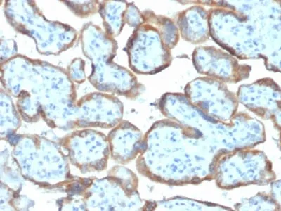 Anti-TIMP2 (Tissue Inhibitor of Metalloproteinase 2) (TIMP2/2044) - image 1