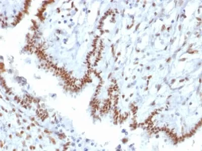 Anti-TLE1 (Synovial Sarcoma Marker) (TLE1/2085) - image 1