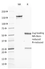 Anti-ZAP70 (Chronic Lymphocytic Leukemia Marker) (ZAP70/2046) - image 2