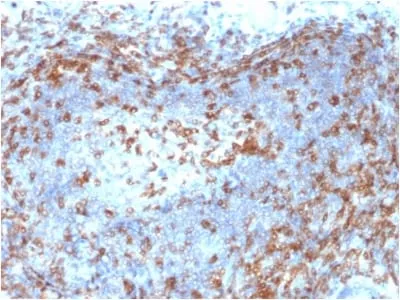 Anti-ZAP70 (Chronic Lymphocytic Leukemia Marker) (ZAP70/2046) - image 1