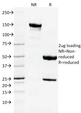 Anti-CD3e (T-Cell Marker) (C3e/2478) - image 2