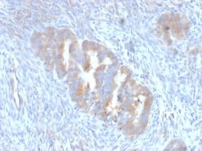 Anti-ATG5 (Autophagy Marker) (ATG5/2101) - image 2