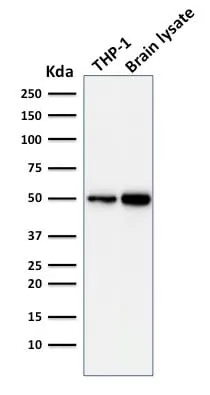 Anti-ATG5 (Autophagy Marker) (ATG5/2101) - image 3