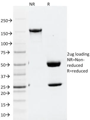 Anti-ATG5 (Autophagy Marker) (ATG5/2101) - image 4