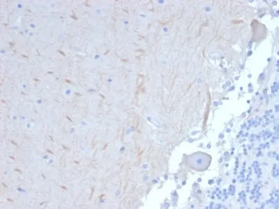 Anti-ATG5 (Autophagy Marker) (ATG5/2101) - image 1