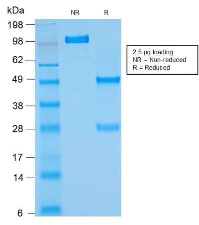 Anti-Bcl-2 (Apoptosis & Follicular Lymphoma Marker) (rBCL2/782), Biotin conjugate - image 2