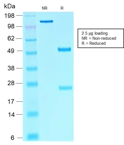 Anti-SOX10 (Melanoma Marker) (rSOX10/1074), Biotin conjugate - image 2