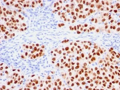 Anti-SOX10 (Melanoma Marker) (rSOX10/1074), Biotin conjugate - image 1