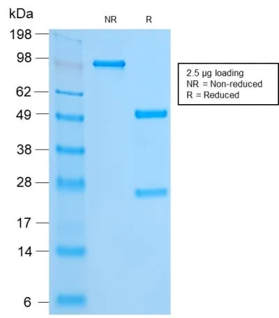Anti-FOXA1 / HNF3A (FOXA1/2230R), Biotin conjugate - image 2