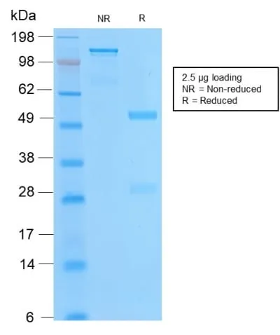Anti-Bcl-2 (Apoptosis & Follicular Lymphoma Marker) (BCL2/2210R), Biotin conjugate - image 2