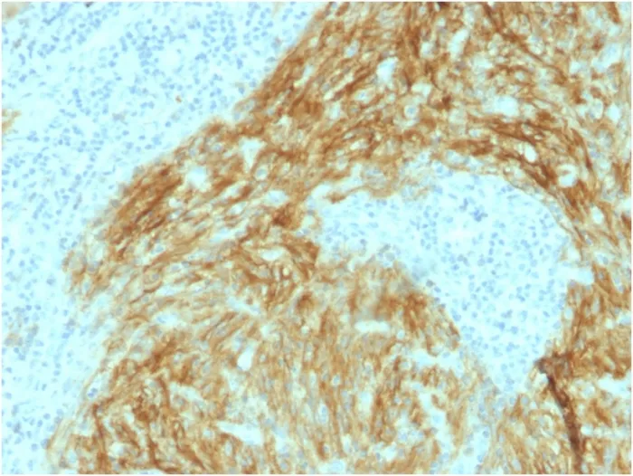 Anti-CD21 (Mature B-Cell & Follicular Dendritic Cell Marker) (CR2/1952), Biotin conjugate - image 1