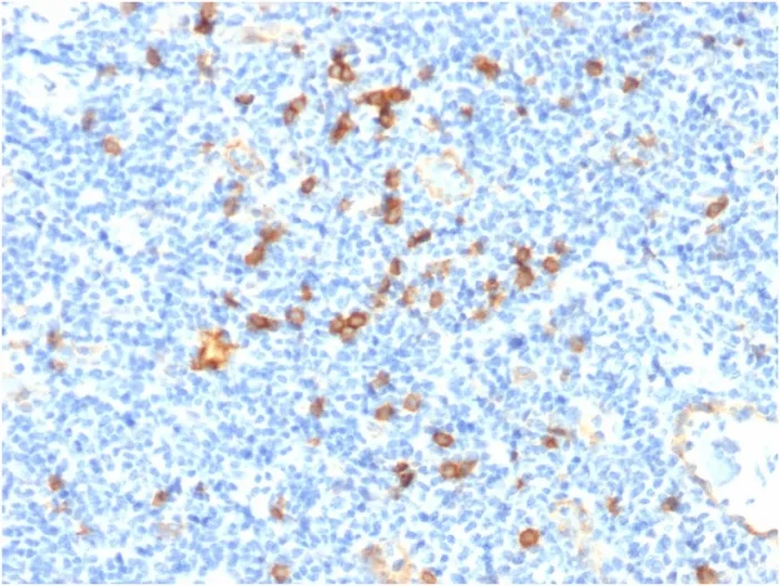 Anti-IL3RA / CD123 (Acute Myeloid Leukemia Marker) (IL3RA/1531), Biotin conjugate - image 1