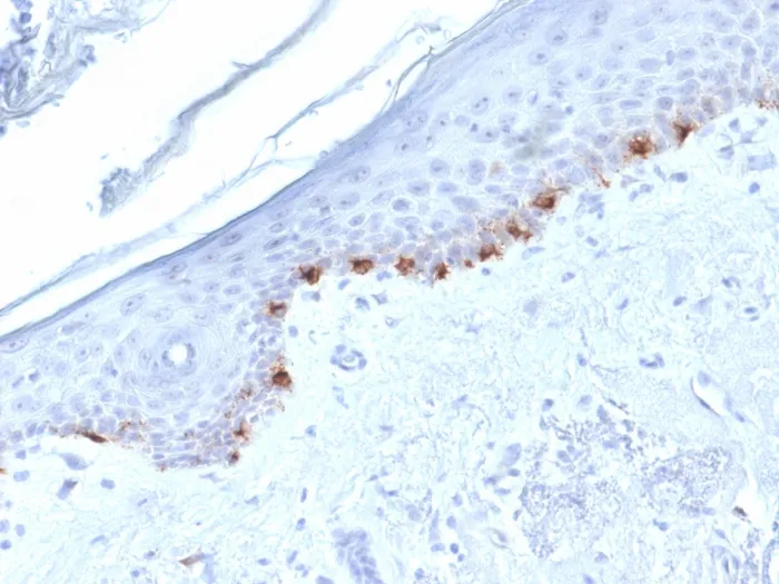 Anti-Tyrosinase-Related Protein-1 (TYRP-1) (Melanoma Marker) (TYRP1/1986), Biotin conjugate - image 1