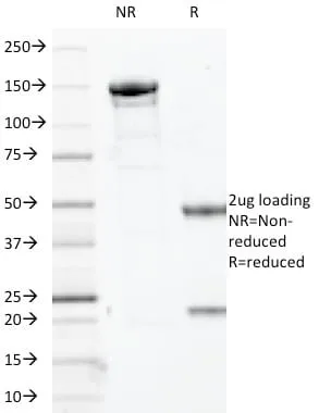Anti-p63 (Squamous, Basal & Myoepithelial Cell Marker) (TP63/2427), Biotin conjugate - image 2