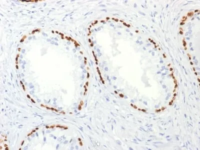Anti-p63 (Squamous, Basal & Myoepithelial Cell Marker) (TP63/2427), Biotin conjugate - image 1