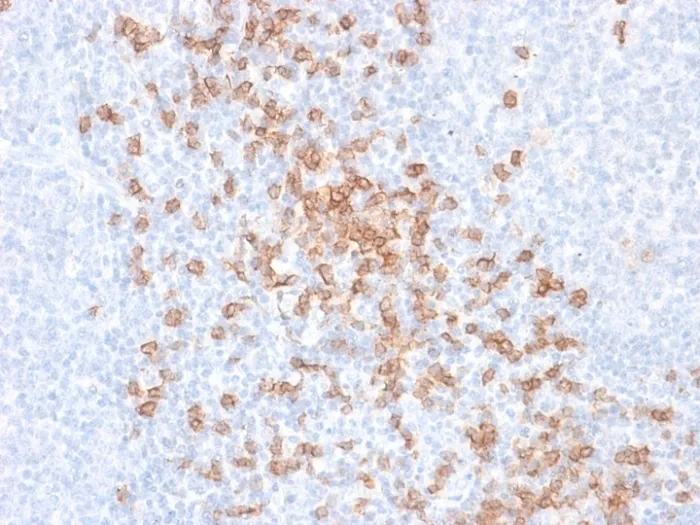 Anti-CD8A (Cytotoxic-&Suppressor T-Cell Marker) (rC8/468), Biotin conjugate - image 1