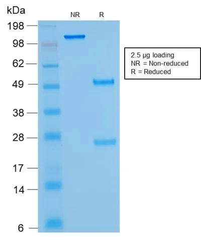 Anti-Human Kappa Light Chain (B-Cell Marker) (rKLC264), Biotin conjugate - image 2