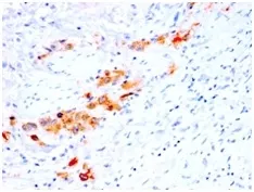 Anti-CD44v4 (Marker of Tumor Metastasis) (rCD44v4/1219), Biotin conjugate - image 1